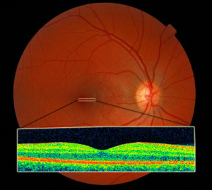 normal retina oct image