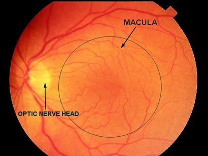 macular-degeneration – Ewan Stilwell Optometrist Mentone